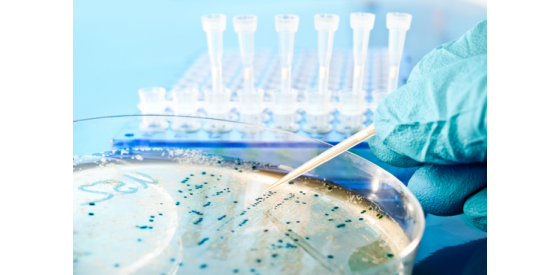 E. Coli VTEC drinking water test E. Coli VTEC drinking water test