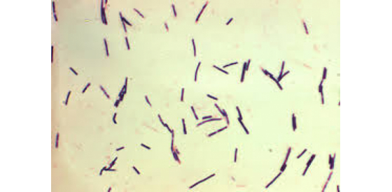 Clostridium Perfringens Clostridium Perfringens