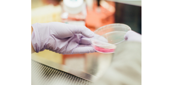 scientist wearing gloves holding a petri dish in a laboratory